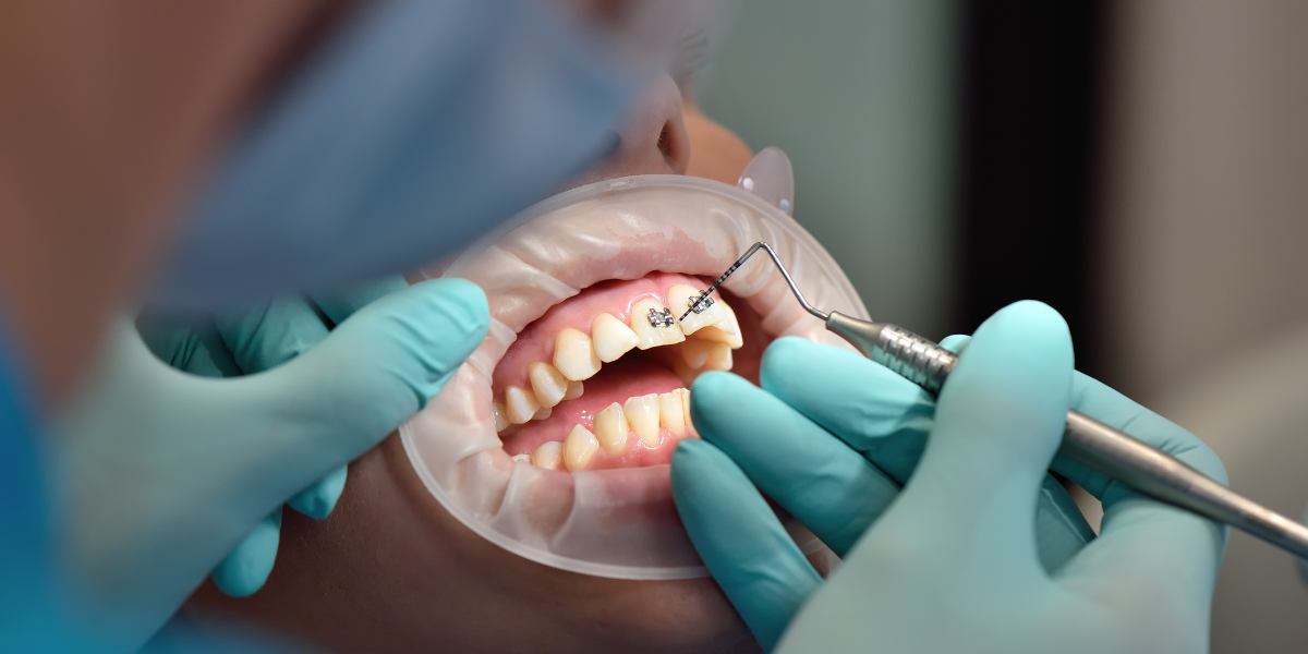 A student observing a dentist at work during a dental work experience placement in a UK practice